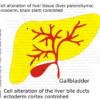 Liver, Gallbladder + Bile Ducts - Organ Graphic