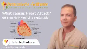 What causes Heart Attack?
