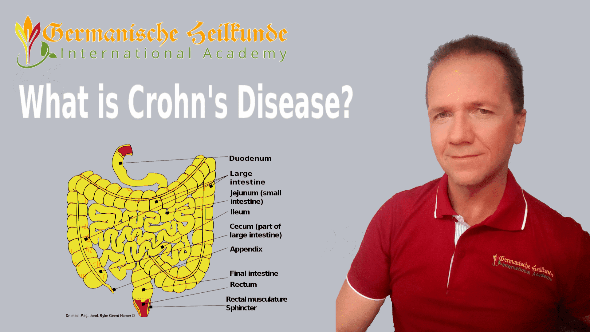 crohn-s-disease-sexuality-in-chronic-illness-fa-20