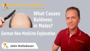 What Causes Baldness in Males?