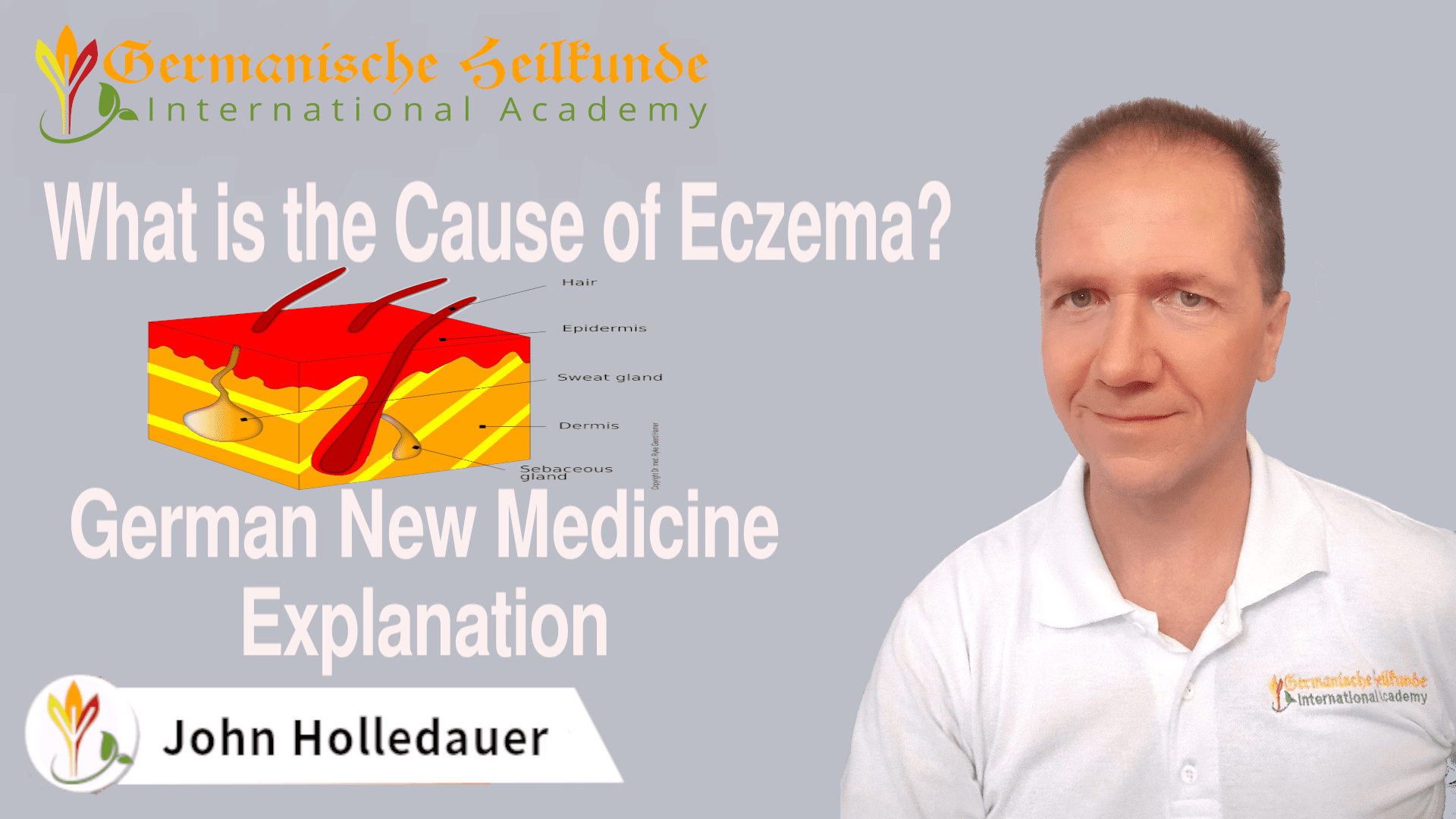 What is the Cause of Eczema?